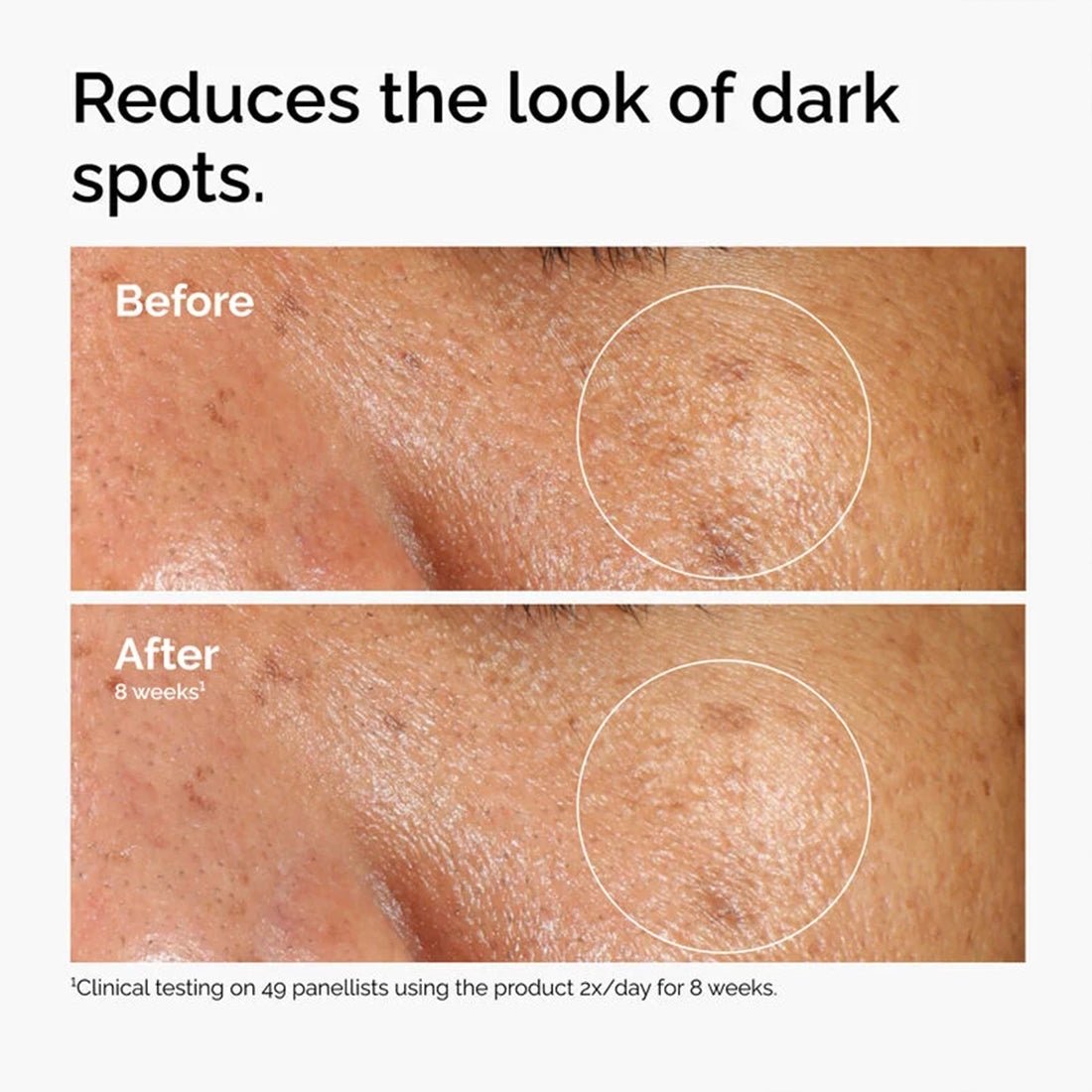 Alpha Arbutin 2% + Ha Siero Antimacchie 30 ML_ORD3674_THE ORDINARY-4