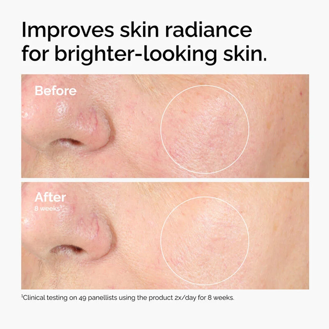Alpha Arbutin 2% + Ha Siero Antimacchie 30 ML_ORD3674_THE ORDINARY-5