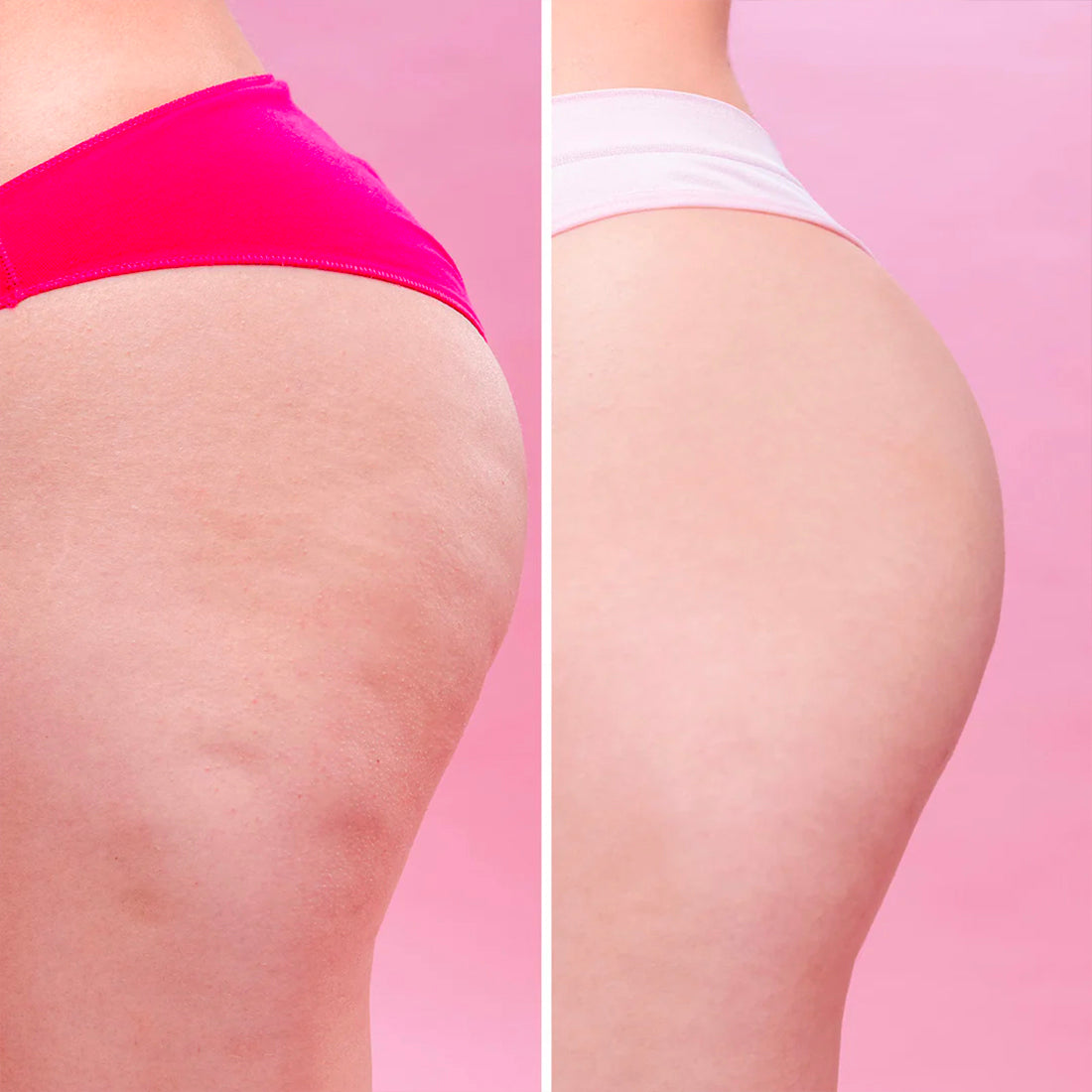 Cellulite Remover Siero Anticellulite Ad Azione Ultra Rapida_ECO7471_Eco Bio Boutique-7