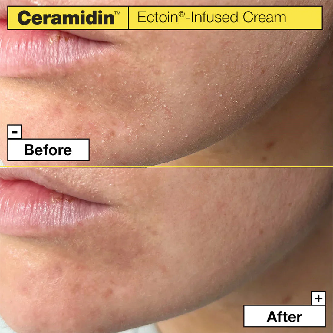 Ceramidin Ectoin-infused Cream 50 ML_JARH72C01_DR. JART-3