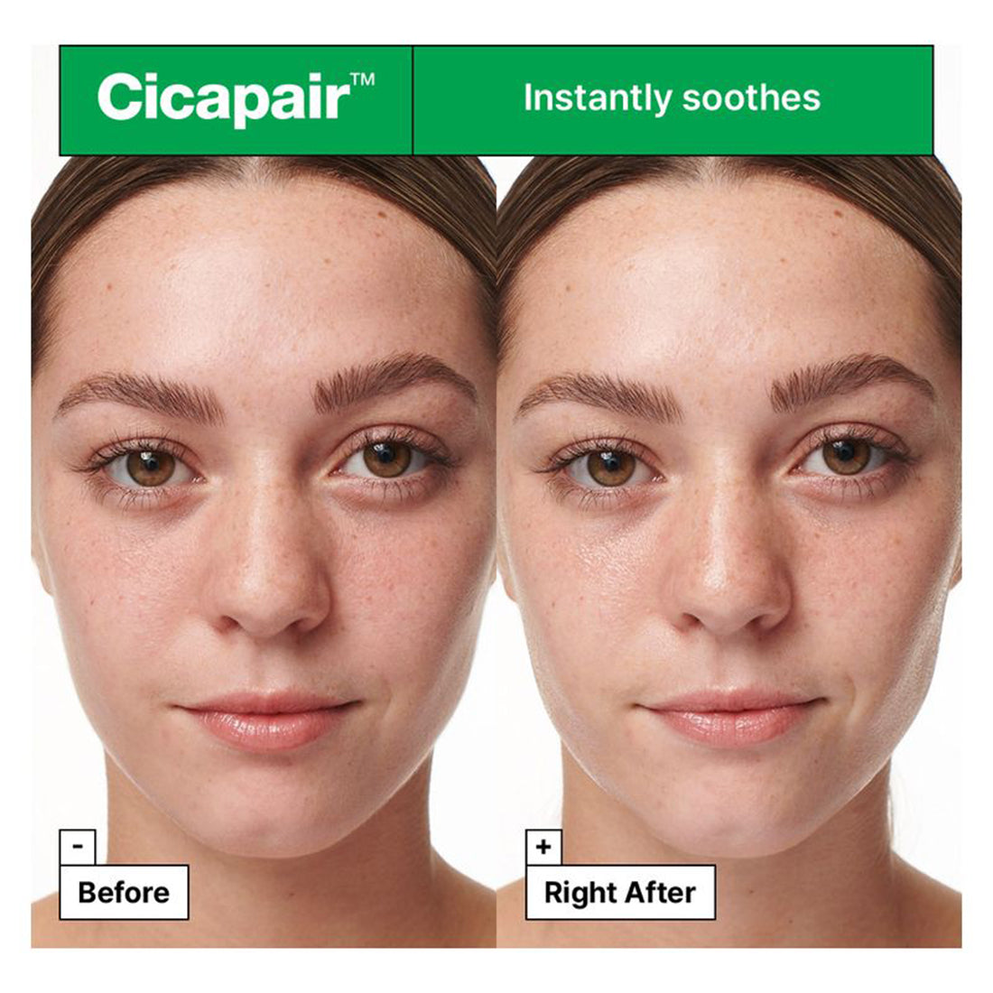 Cicapair Intensive Soothing Repair Serum 30 ml_JARH7NC01_DR. JART-4