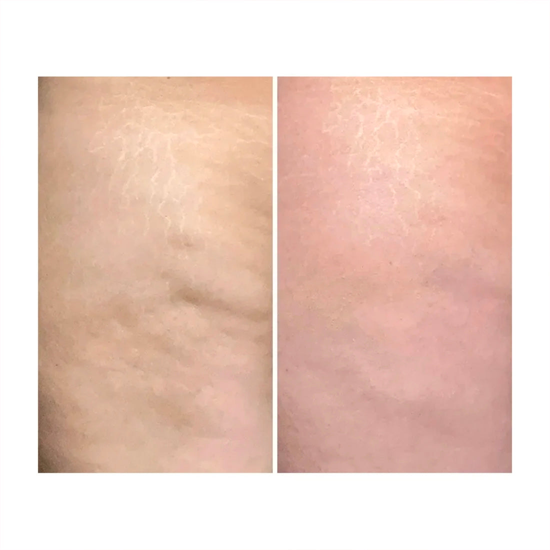 Crema Corpo Anticellulite_ECO0979_Eco Bio Boutique-4