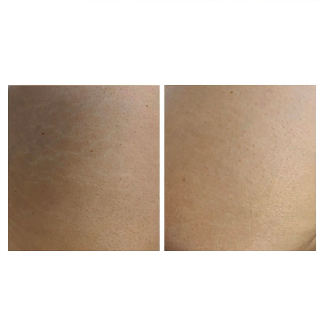 Crema Corpo Smagliature e Cicatrici_ECO5432_Eco Bio Boutique-4
