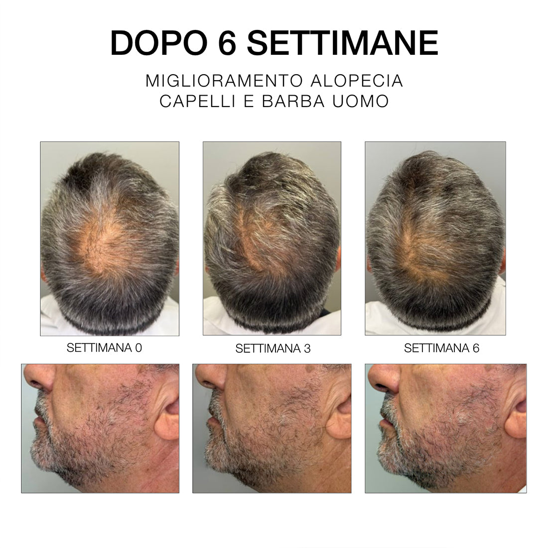 Estremi Rimedi Siero Rinforzante Ridentificante_DDPDHC23400_Diego Dalla Palma-6