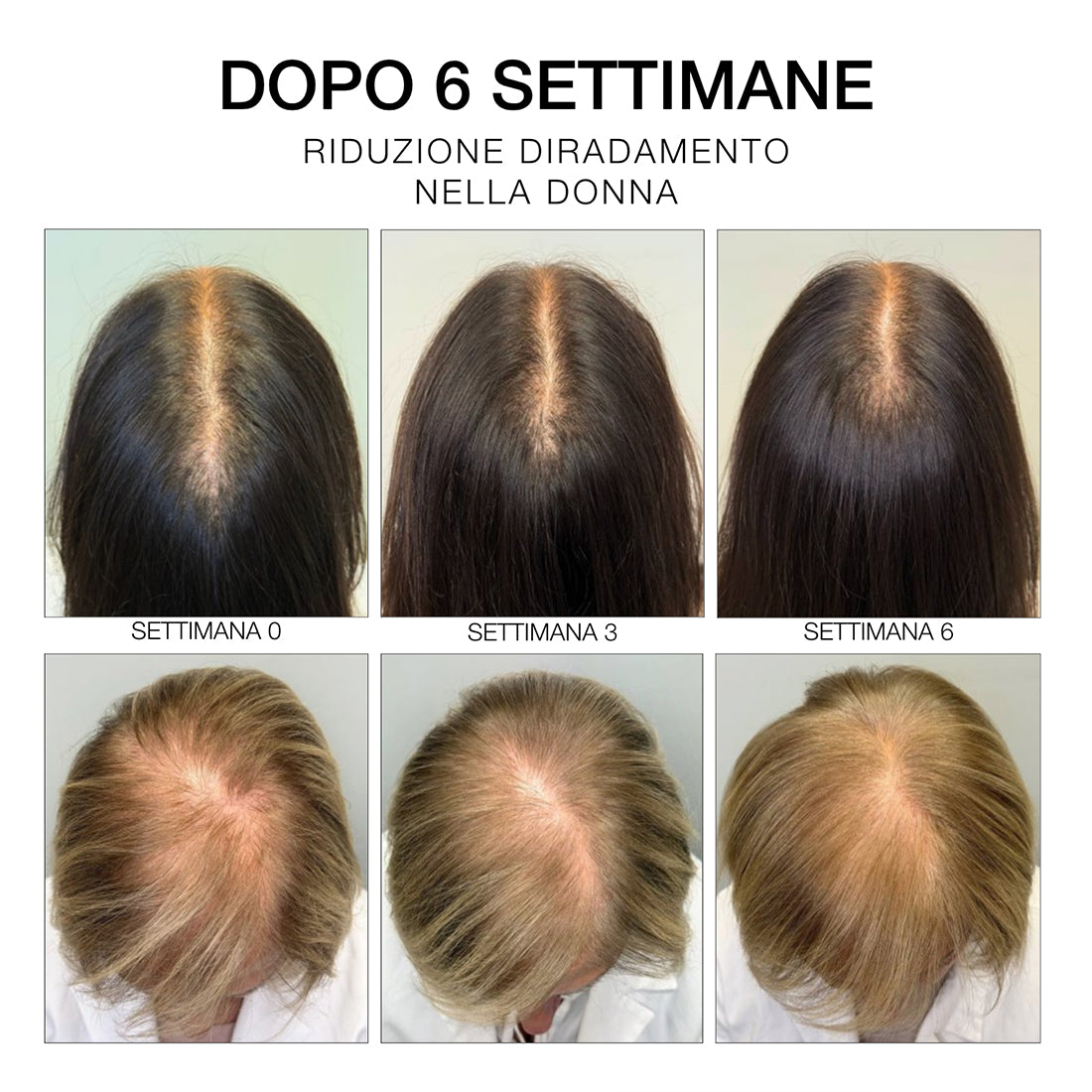 Estremi Rimedi Siero Rinforzante Ridentificante_DDPDHC23400_Diego Dalla Palma-7