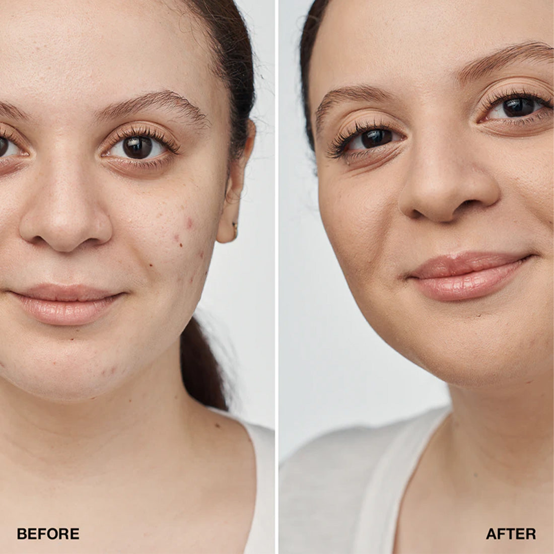 Even Better Clinical Serum Foudation Fondotinta Clinico SPF 20 CN52 Neutral_CLIKY19050000_Clinique-2