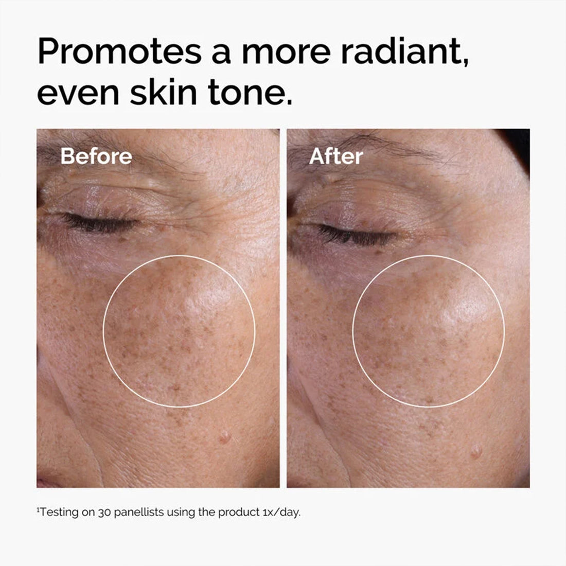 Glycolic Acid 7% Exfoliating Toner Tonico Levigante 100 ML_ORD4053_THE ORDINARY-4