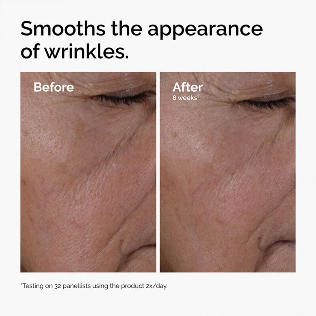 Multi Peptide + Ha Serum Siero Anti-età 30 ML_ORD1885_THE ORDINARY-4