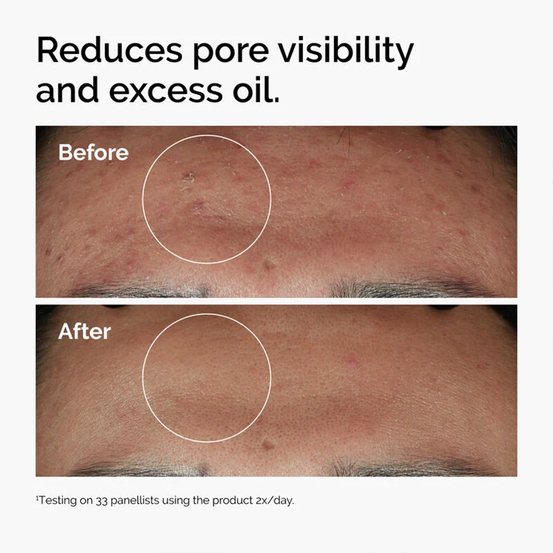 Niacinamide 10% + Zinc 1% Siero Universale 60%_ORD5958_THE ORDINARY-4