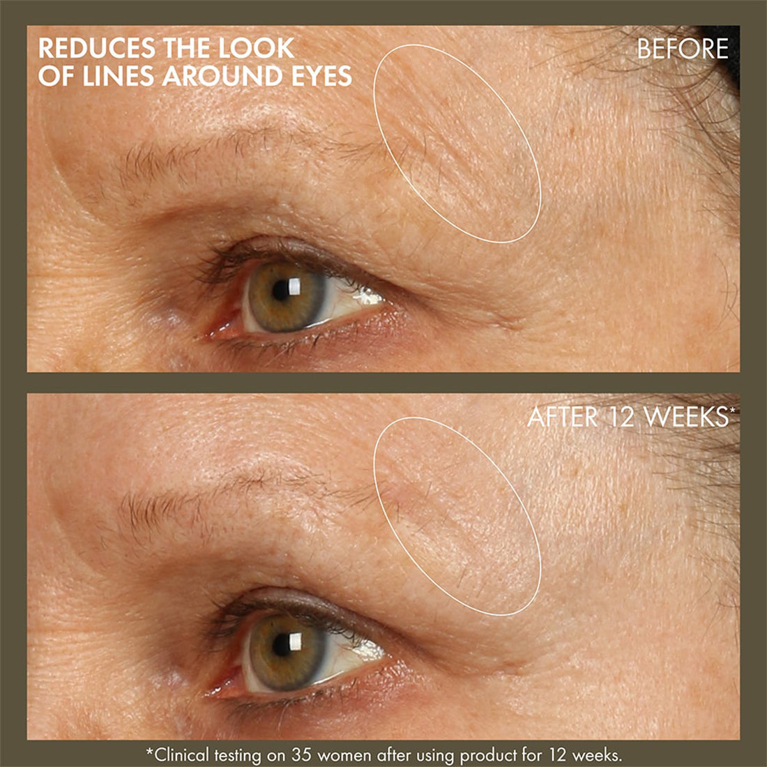Plantscription Active Wrinkle Correction Serum Siero Viso Antirughe 30 ML_ORI0Y6L01_ORIGINS-3