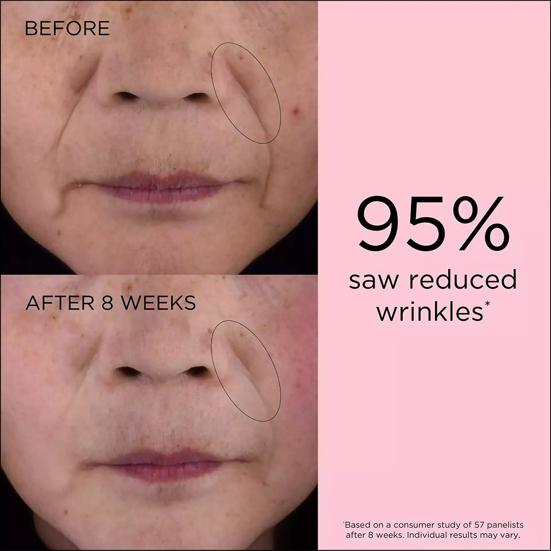Retinol + HPR Ceramide Capsules Rapid Skin Renewing Serum Capsule Siero Rinnovatore_ARD40301388_Elizabeth Arden-4