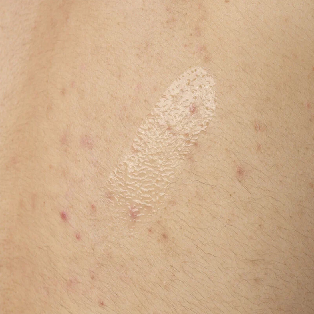 Salicylic Acid 0,5% Body Serum Siero Esfoliante Corpo 240 ML_ORD3520_THE ORDINARY-3