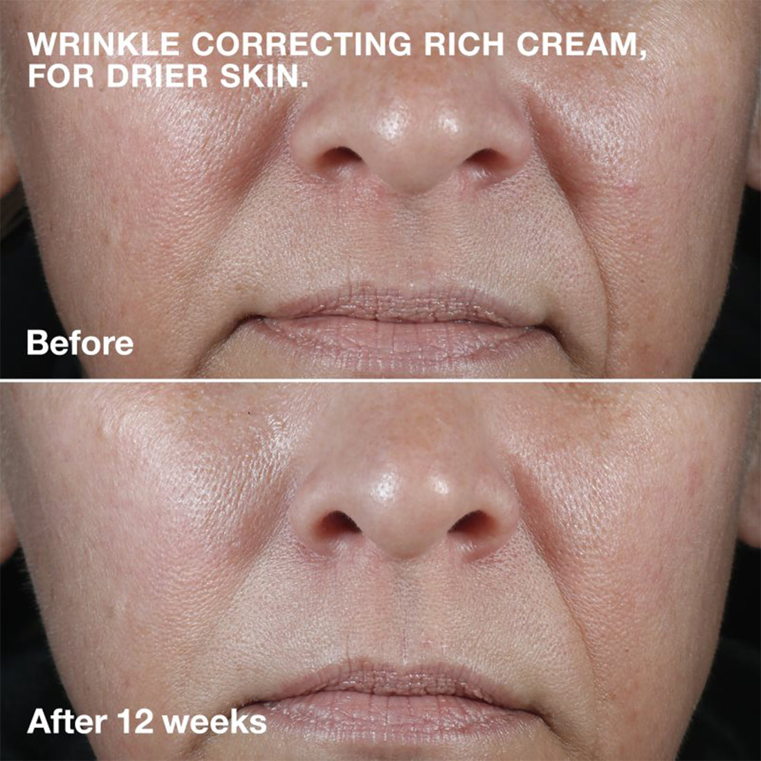 Smart Clinical™ Repair Wrinkle Correcting Cream Crema Viso Antirughe 75 ml_CLI9744_Clinique-3